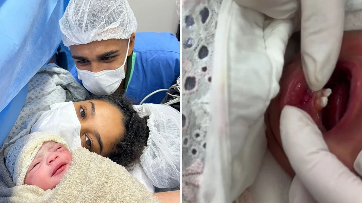 Bebê nasce com dentes em Vitória e passa por cirurgia aos seis dias de vida